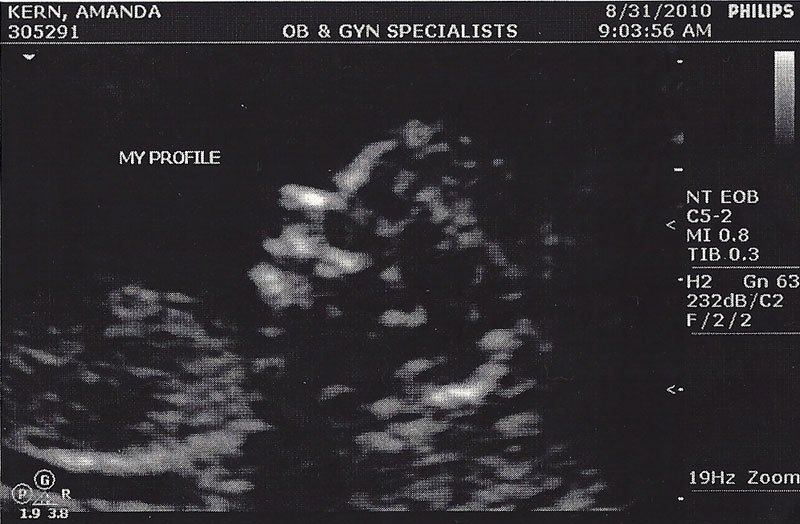 ultrasound-08312010-2